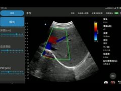 CE Menyetujui Electronic Convex Array USG Cardiac Probe Ultrasound Untuk Android
