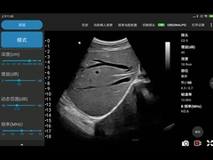 Perangkat Ultrasound Wireless Convex Array Elektronik Untuk Ponsel