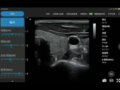 256 Scan Lines Ipad Ultrasound Transducer Wireless Ultrasound Probe Untuk PICC