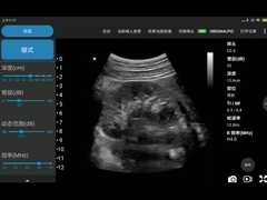 CE Ditandai Pemindai Ultrasound Wifi Portabel 3,6MHz JPEG BMP PNG MPEG-4