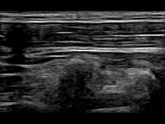 WiFi 12.6cm Mesin Ultrasound Doppler Portabel Jarak Jauh 30 Fps