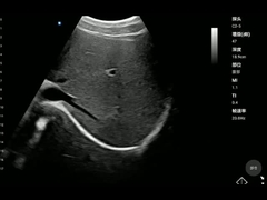 ISO13485 Portable Medical Device Convex Probe Handheld Health Scanner