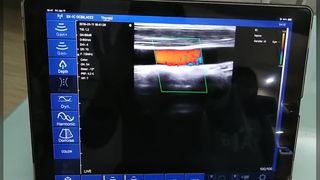Probe Ultrasound Nirkabel Kepala Ganda 128 Elemen