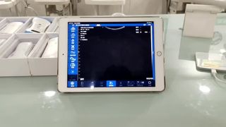 Probe Ultrasound Nirkabel Kepala Ganda untuk Diagnostik OB GYN