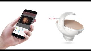 Kamera Janin Marvoto M1- Ultrasound Genggam 3D
