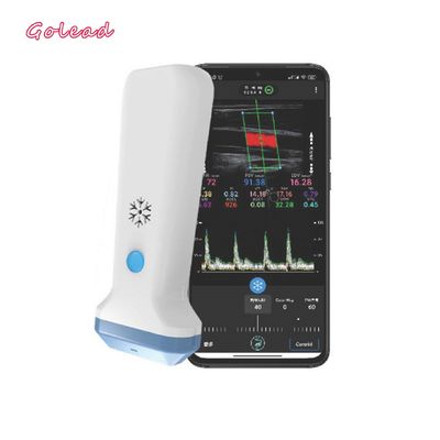 12MHz 3000mAh Wireless Probe Type Ultrasound Scanner Untuk Iphone