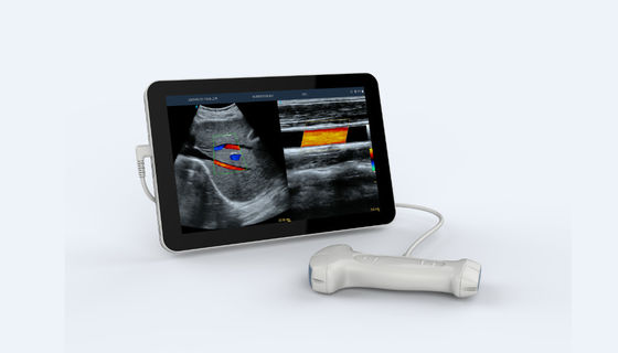 Beli 5V Dual Head Portable Handheld Ultrasound Scanner Frekuensi Tinggi online manufacture