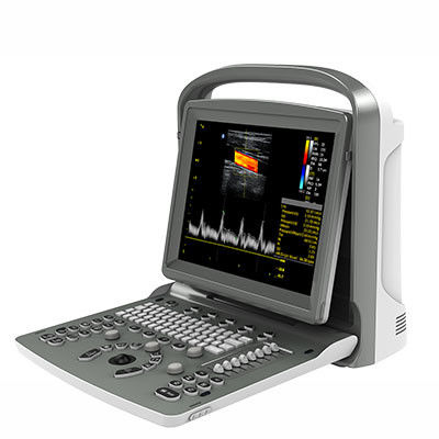 Beli 12 Inch LED Chison Portable Ultrasound Machine ECO6 Dengan Baterai Tahan Lama online manufacture