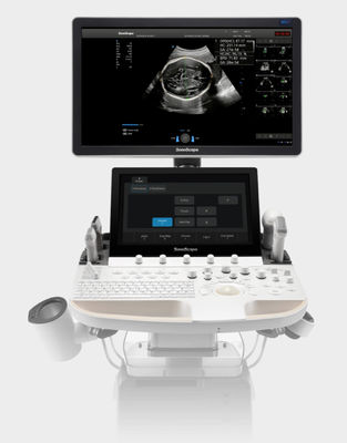 Beli Mesin Ultrasound SonoScape Berbasis Kecerdasan Buatan Trolley P60 Exp online manufacture