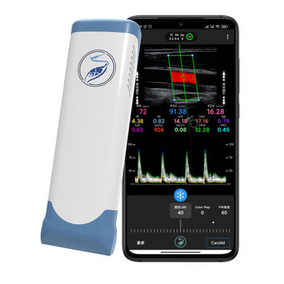 Beli Pemindai Ultrasound Genggam Nirkabel 12MHz untuk iPhone & iPad | Probe Doppler Warna Array Linier Elektronik online manufacture