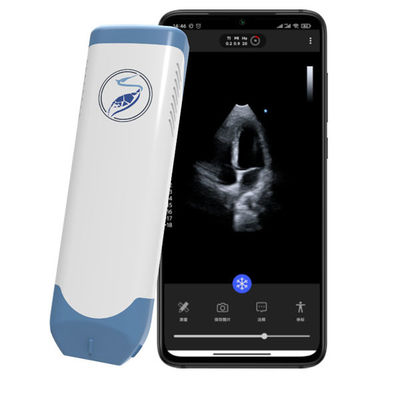 Beli Pemindai Ultrasound Genggam Array Bertahap Nirkabel 5MHz Pocket Cardiac Ultrasound untuk POCUS Echocardiography online manufacture