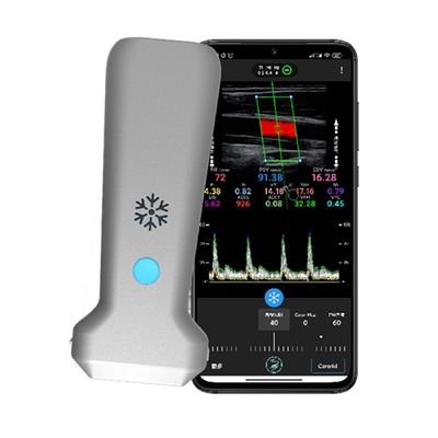 Beli Pemindai Ultrasound Doppler Warna Genggam Linier Nirkabel WiFi | Pencitraan Waktu Nyata 30 FPS | Probe USG Medis Portabel online manufacture