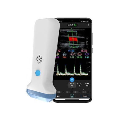 Beli Pemindai Ultrasound Genggam Linier Nirkabel | Probe USG Doppler Warna Portabel 4/8.3/12MHz online manufacture