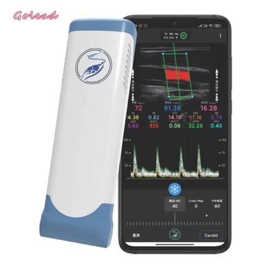 Beli Pemindai Ultrasonik Portabel Nirkabel Elektronik Linear Array Wifi 12MHz online manufacture
