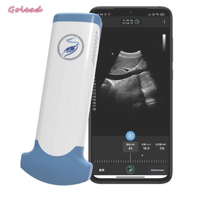 Beli Perangkat Ultrasound Wireless Convex Array Elektronik Untuk Ponsel online manufacture