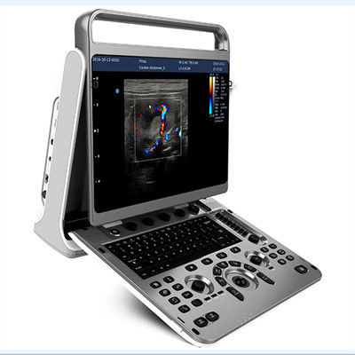 Beli Desain Ergonomis Mesin Ultrasound Portabel Chison EBit 30 online manufacture