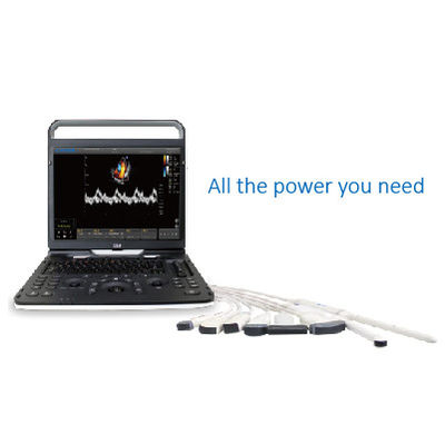 Beli 128 Element Wifi Ultrasound Chison EBit 60 Untuk Kardiovaskular online manufacture
