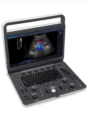Beli 15.6 inci LED Sonoscape E1 Exp Mesin Ultrasound BW Ultrasound online manufacture