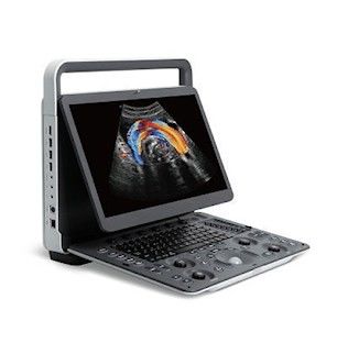 Beli Panoramic Imaging Mesin USG Portabel SonoScape E2 PRO online manufacture