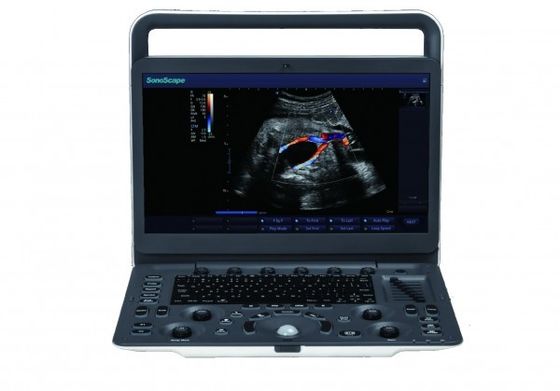 Beli 7 Tingkat Pencitraan Mesin Ultrasound Portabel SonoScape E3 Dengan Monitor 15,6 Inci online manufacture