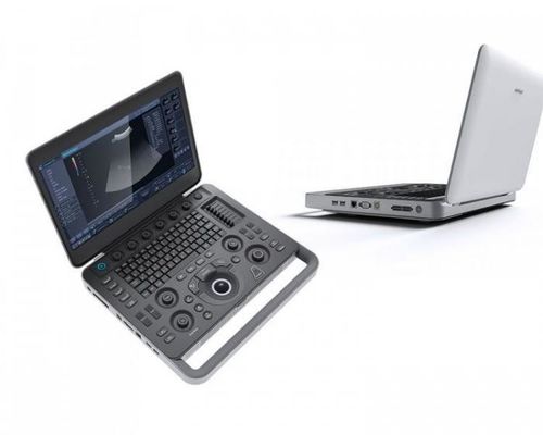 Beli Smart Sight 500GB Laptop Mesin Ultrasound SonoScape Dengan LCD 15,6'' online manufacture