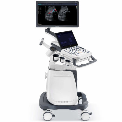 Beli 500GB Mesin Pencitraan Spasial Senyawa SonoScape Ultrasound P25 online manufacture