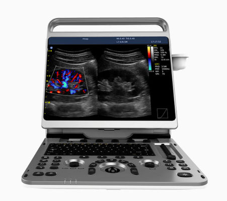Beli Mesin Ultrasound Jantung Portabel Chison EBit 50 16,5lbs online manufacture