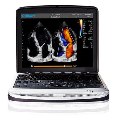 Beli Mesin Ultrasound Laptop 4D Chison SonoBook 9 Mudah Dibawa online manufacture
