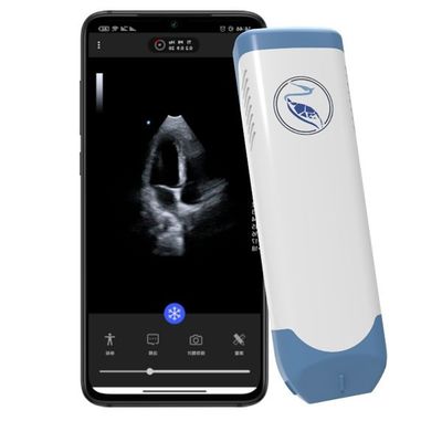 Beli Kedalaman 18.9cm Pemindai Ultrasound Genggam Untuk Iphone 3.6MHz online manufacture