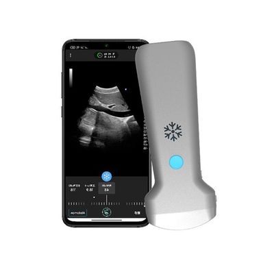 Beli Pemindai Ultrasound Genggam Cembung Nirkabel ISO13485 | Probe USG Doppler Warna Portabel online manufacture