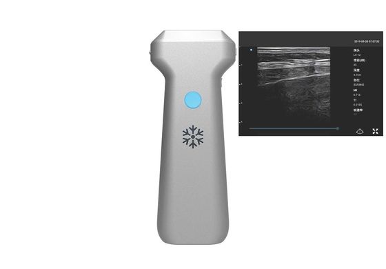 Beli Mesin Ultrasound Portabel Nirkabel Linear Probe 32 Saluran online manufacture