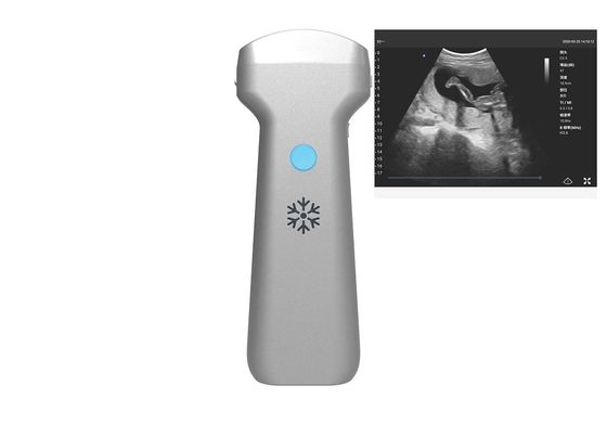 Beli Elektronik Convex Array Convex Wireless Ultrasound Probe 2MHz 3.6MHz 5MHz online manufacture
