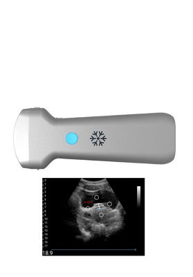Beli Ultrasonication Convex Wireless Ultrasound Probe Untuk Ginekologi online manufacture
