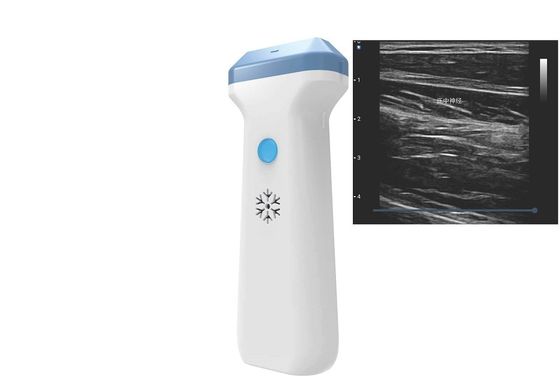 Beli DICOM BMP PNG JPEG 128 Elemen Wifi Ultrasound Probe 80 To180dB online manufacture
