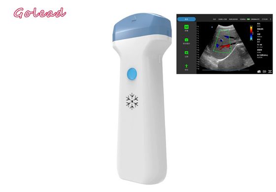 Beli Probe Ultrasound Nirkabel Ipad Anestesi Untuk Ujian POCUS Perawatan Primer online manufacture