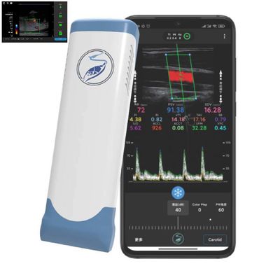 Beli 256 Scan Lines Ipad Ultrasound Transducer Wireless Ultrasound Probe Untuk PICC online manufacture