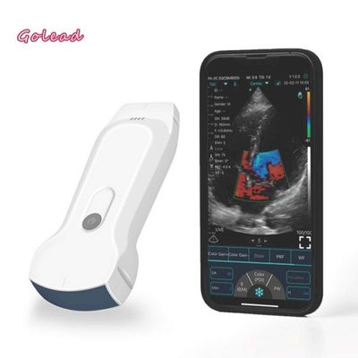 Beli Probe Ultrasound Nirkabel 3 in 1 dengan 8 Penyesuaian Koneksi WiFi TGC online manufacture