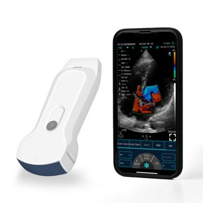 Beli Pemindai Ultrasound Genggam IPad Portabel POCUS Untuk Diagnosis Klinis online manufacture