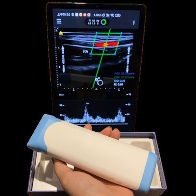 Beli Performa Tinggi Elektronik Array Linear PICC Handheld Ultrasound Scanner online manufacture