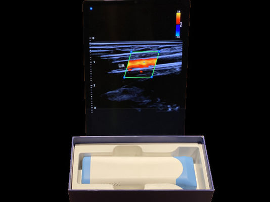 Beli Advanced Handheld Ultrasound Scanner 0.2kg Dengan Baterai 3000mAh Untuk Medis online manufacture