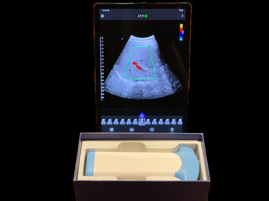 Beli Probe Ultrasound Nirkabel Ukuran Saku Premium 128 Elemen untuk Keadaan Darurat online manufacture