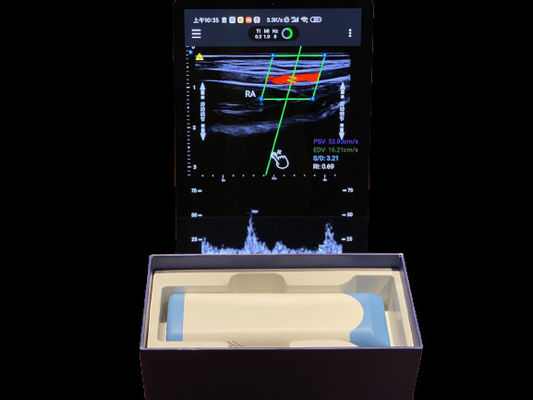 Beli Pemindai Ultrasound Genggam Linear Array Elektronik dengan Waktu Kerja 2 Jam online manufacture