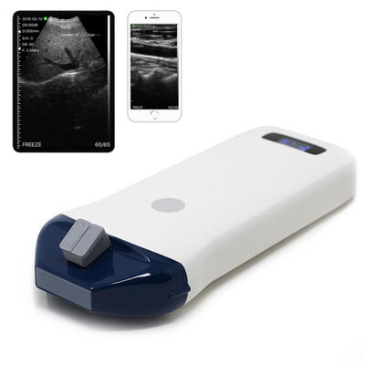 Beli Sistem Ultrasound Genggam Nirkabel untuk Panduan Jarum dan Prosedur Intervensi online manufacture