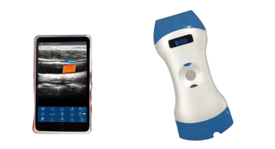 Beli Probe Ultrasound Genggam Nirkabel Kepala Ganda 128 Elemen — Satu Probe untuk Pencitraan Dalam, Pencitraan Dangkal, dan Diagnosis Titik Perawatan online manufacture
