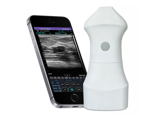 Beli Pemeriksaan Ultrasonografi Kulit Frekuensi Tinggi 24MHz untuk Pengobatan Estetika, Dermatologi, dan Panduan Prosedur Suntikan online manufacture