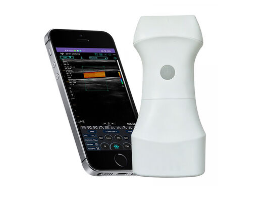Beli Probe Ultrasound Saku 192 Elemen — Pencitraan POCUS Resolusi Tinggi Profesional di Telapak Tangan Anda. online manufacture