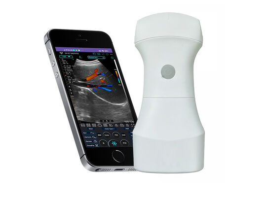 Beli Pemindai Ultrasound Cembung Saku Nirkabel dengan Baterai yang Dapat Diganti untuk Pencitraan Klinis Portabel online manufacture