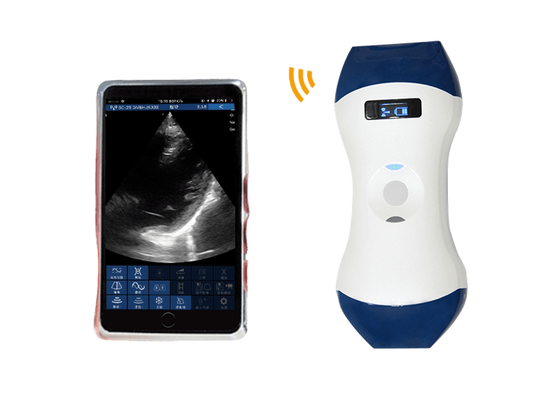 Beli FDA CE ISO13485 Probe Ultrasound Genggam Nirkabel Ukuran Telapak Tangan dengan Array Bertahap dan Kepala Ganda Linear untuk POCUS online manufacture