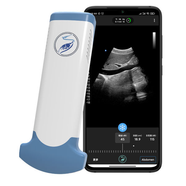CE Ditandai Pemindai Ultrasound Wifi Portabel 3,6MHz JPEG BMP PNG MPEG-4