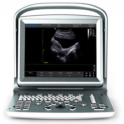 12''LED Color Dopper System Chison ECO5 Chison Veterinary Ultrasound